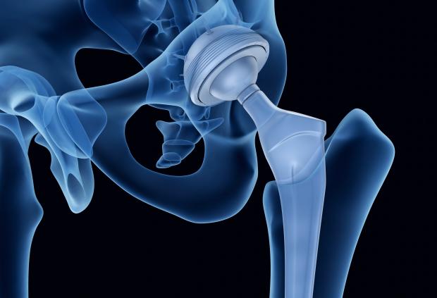 3D rendering of ball and socket joint orientation in the pelvic bone against black background