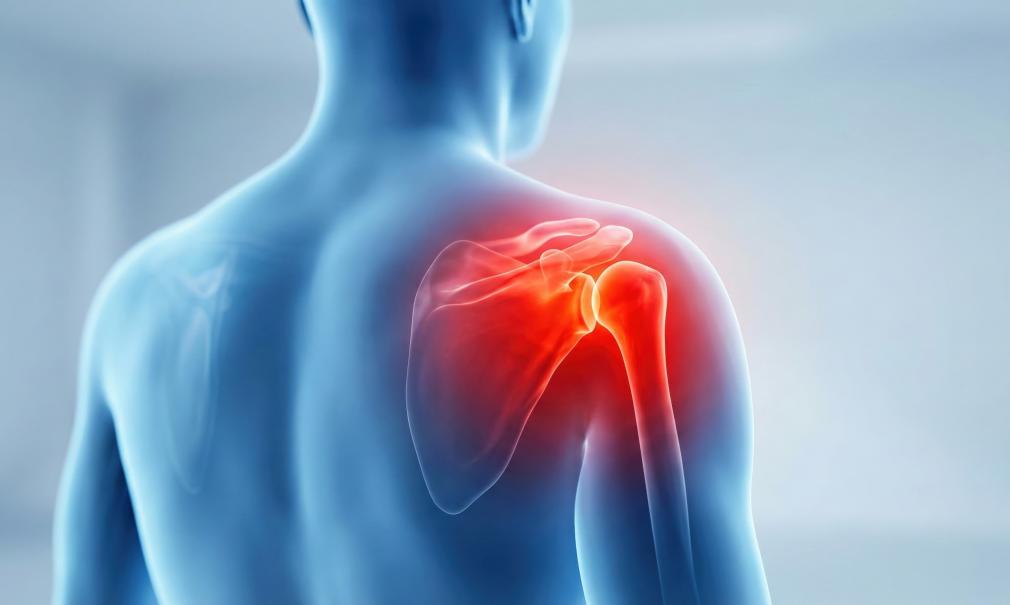 Illustration of shoulder joint anatomy with glowing pain area