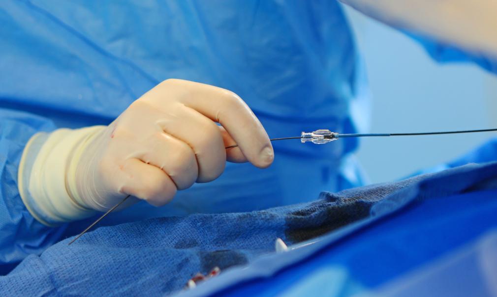 closeup of an endovascular device being used in the operating room