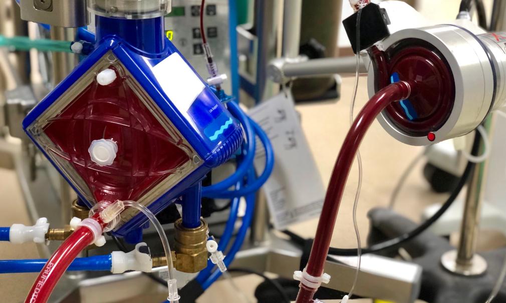 Closeup of ECMO equipment actively pumping and oxygenating blood