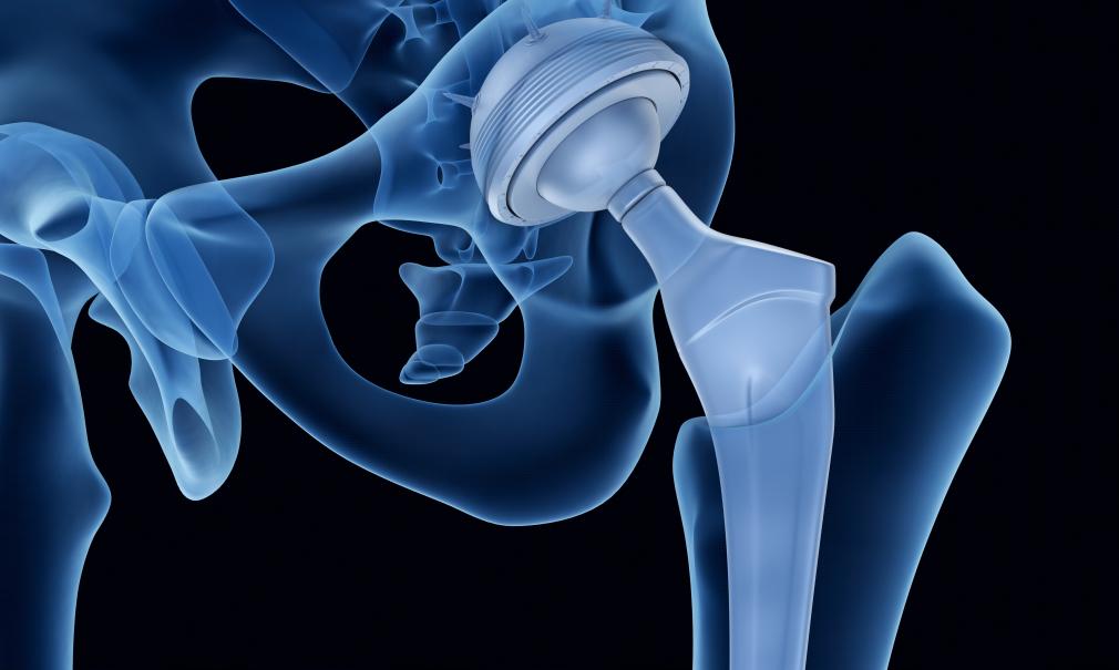 3D rendering of ball and socket joint orientation in the pelvic bone against black background