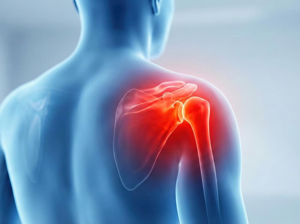 Illustration of shoulder joint anatomy with glowing pain area