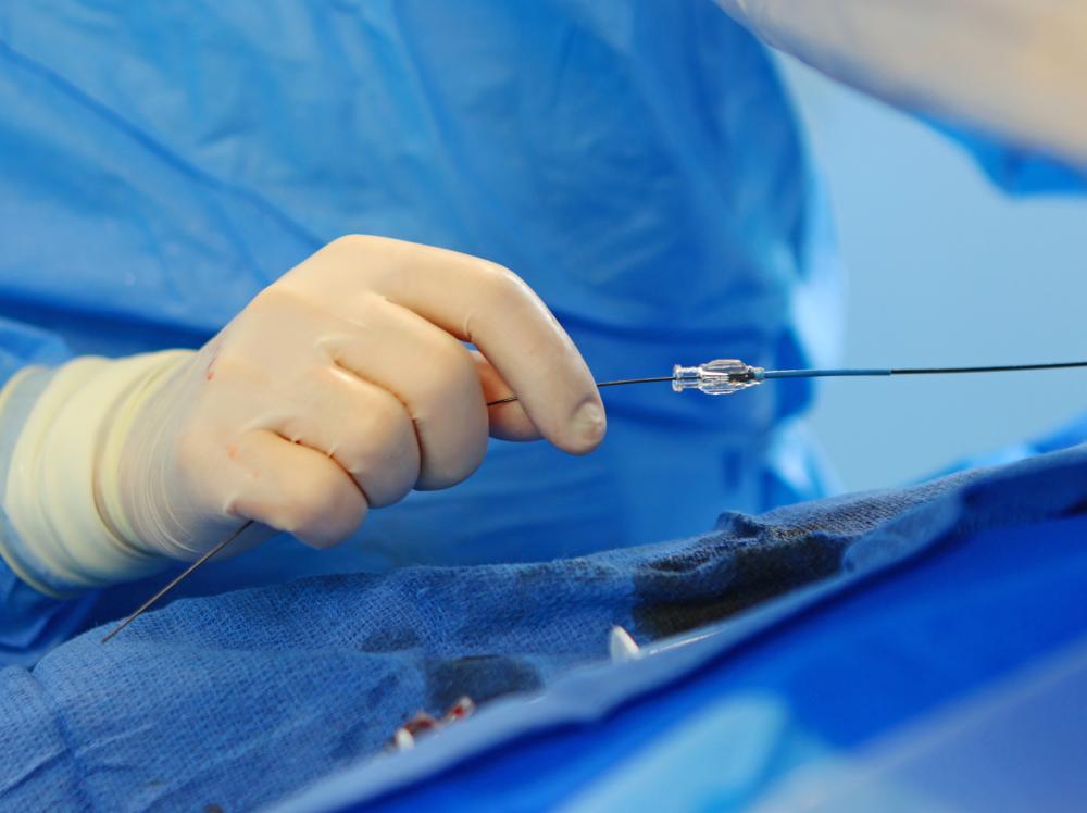 closeup of an endovascular device being used in the operating room