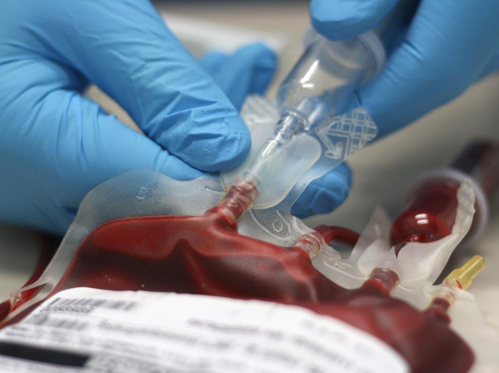 Closeup of gloved hands using a blood transfusion bag