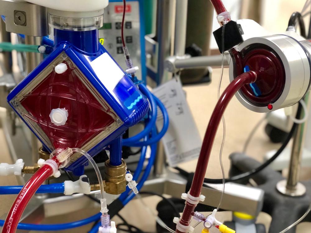 Closeup of ECMO equipment actively pumping and oxygenating blood