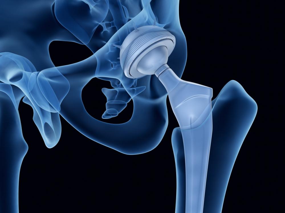 3D rendering of ball and socket joint orientation in the pelvic bone against black background